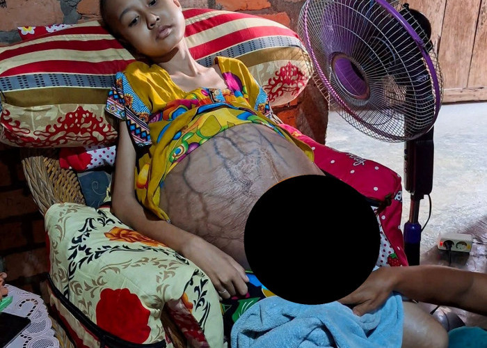 Di Balik Seragam yang Tergantung, Nopal Penderita Tumor Menanti Kesempatan Sembuh