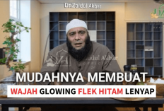 Tips Menghilangkan Flek Hitam Ala dr Zaidul Akbar Pakai Bahan Alami, Wajah Bebas Kusam Tanpa ke Dokter