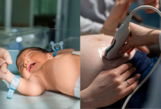 Adakah Aturan Mengubur Ari-ari Bayi dalam Islam? Begini Pesan Buya Yahya untuk Laki-laki yang Baru Jadi Ayah 