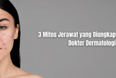 Jangan Percaya! Ini 3 Mitos Jerawat yang Diungkap Dokter Dermatologi, Nomor 1 Sering Keliru