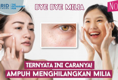 5 Cara Menghilangkan Milia Dengan Skincare yang Tepat, Yuk Cari Tau!