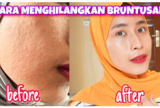 7 Cara Efektif Mengatasi Bruntusan di Wajah dengan Solusi Rumahan