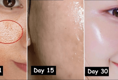 7 Obat Pengecil Pori-pori Wajah Alami yang Kalahin Resep Dokter, 1 Minggu Auto Mulus, Ini Triknya Girls...