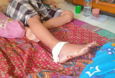 Dramatis! Seorang Remaja Lolos Dari Terkaman Buaya Setelah Dibantu 2 Temannya, Begini Kejadiannya.