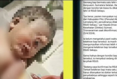3 Fakta Bayi Bermata Satu yang Lahir di RSUD Sekayu Musi Banyuasin, Mengindap Penyakit Cyclopia