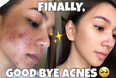 4 Sunscreen High End Bikin Putih Dan Ampuh Hilangkan Bekas jerawat, Cuma Ratusan Ribu di Shopee Bikin Glowing