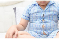 Anak Obesitas Tak Perlu Stop Susu, Ini Penjelasan Dokter Anak yang Sering Disalahpahami Orang Tua