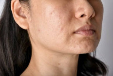4 Kebiasaan yang Bisa Sebabkan Muka Bruntusan, Kamu Wajib Tau.. 