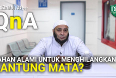 5 Cara Alami Mengatasi Mata Panda Agar Wajah Lebih Segar dan Cerah, Yuk Cobain!