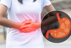 Stres Bisa Merusak Lambung! Ini Fakta Mengejutkan Hubungan Stres dan Masalah Pencernaan