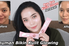 5 Merk Susu Kolagen yang Paling Ampuh Bisa Memutihkan Kulit, Salah Satunya ada di Indomaret, Cek di Sini!