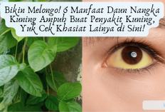 Bikin Melongo! 6 Manfaat Daun Nangka Kuning Ampuh Buat Penyakit Kuning, Yuk Cek Khasiat Lainya di Sini!