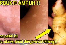 7 Cara Alami Menghilangkan Panu di Wajah dengan Sangat Mudah, InsyaAllah Bersih dalam 1 Hari Lho!