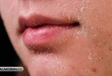 Rahasia Perawatan Kulit Kasar dan Kering: Pilihan Tabir Surya dan Langkah Praktis untuk Kulit Sehat