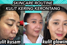 10 Rekomendasi Serum Terbaik untuk Mencerahkan Wajah, Bye-bye Kulit Kusam...