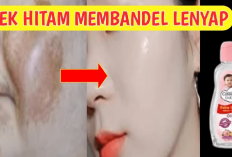 Cobain Sekarang Juga Racikan Baby Oil Untuk Menghilangkan Flek Hitam di Wajah, Ternyata Ini Lho Manfaatnya