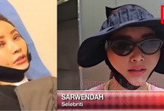 Tegas! Sarwendah Ungkap Alasan Operasi Plastiknya, Gegara Ruben Onsu Gugat Cerai?