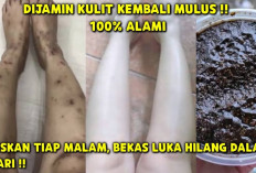 Inilah 5 Bahan Alami untuk Menghilangkan Bekas Luka Koreng yang Hitam dan Bikin Kulit Cerah Permanen 