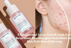 5 Rekomendasi Serum Terbaik untuk Kulit Berjerawat, Bisa Hilangkan Noda Hitam dan Bikin Kulit Halus & Glowing