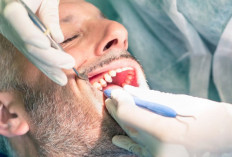 Apakah Cabut Gigi Membatalkan Ibadah Puasa? Begini Fatwa Syaikh Muhammad bin Shalih Al Utsaimin