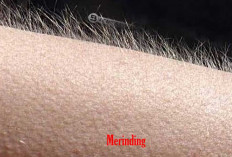 Merinding: Mitos atau Tanda Penyakit? Ketahui Faktanya!