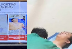 RSCM Beberkan Kondisi Andrie Yunus Pasca Serangan Air Keras, Ini Dampaknya