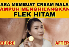 3 Tips Cara Pakai Salep Penghilang Flek Hitam Membandel Paling Manjur, Cobain Seminggu Pasti Cerah
