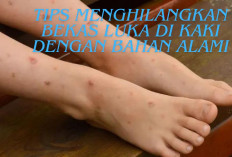 Wow Hilang Dalam 7 hari, Inilah 5 Tips Menghilangkan Bekas Luka di Kaki Cukup dengan Bahan Alami Aja Lho