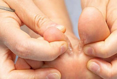 Tak Perlu Repot dan Mahal! 4 Solusi Alami Mengatasi Kutu Air dari Dapur Anda