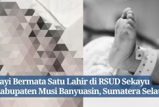 5 Fakta Bayi Bermata Satu yang Lahir di RSUD Sekayu Musi Banyuasin, Benarkah Mengindap Penyakit Cyclopia?