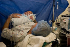 Penting Buat Bumil, 5 Dampak Negatif Melahirkan Secara Caesar