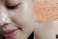 5 Obat Salep Pengecil Pori-pori di Apotik yang Bikin Wajah Kelihatan Mulus Kayak Artis Korea, Mulai dari Rp25K