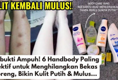 Terbukti Ampuh! 6 Handbody Paling Efektif untuk Menghilangkan Bekas Koreng, Bikin Kulit Putih & Mulus...