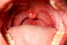 Ada Disini, 7 Cara Alternatif untuk Sembuhkan Radang Tenggorokan secara Alami Tanpa Bahan Kimia!