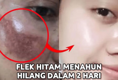 5 Cara Halal Menghilangkan Flek Hitam di Wajah saat Bulan Ramadhan, Lakukan Hal ini Supaya Nggak Batal Puasa!