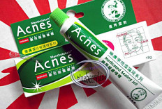 Jerawat Punggung: Solusi Ampuh dengan 5 Obat Rekomendasi, Ada yang Jadi Favorit Lho?