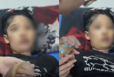 Bocah 12 Tahun Meninggal dengan Luka di Sekujur Tubuh Diduga Dianiaya Ibu Tiri, Ayah Korban Minta Autopsi