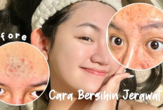 Ciwi-ciwi Yuk Merapat! 4 Trik Merawat Wajah agar Terhindar dari Jerawat dan Beruntusan