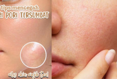 8 Cara Mengatasi Pori-Pori Tersumbat, Bikin Kulit Mulus dan Glowing, Yuk Ikuti Tipsnya...