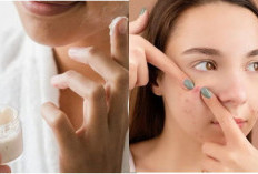 5 Skincare untuk Memperbaiki Skin Barrier yang Rusak Bikin Kulit Lembab dan Sehat, Tidak Hanya Moisturizer!