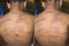 Anak Titipan Dinas Sosial Lubuklinggau Dianiaya Petugas Yayasan, Polisi Tunggu Laporan Resmi