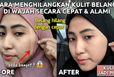 3 Rekomendasi Masker Alami Untuk Memutihkan Wajah Belang, InsyaAllah Pudar Dalam 1 Minggu!