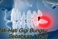 Berikut 6 Fakta Pertumbuhan Gigi Bungsu dan Cara Mengatasi Ketidaknyamanan yang Disebabkannya!