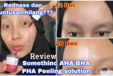 Kulit Makin Glowing dan Mulus! Ini Review Eksfoliasi Somethinc AHA BHA PHA Peeling Solution yang Viral