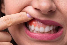  Apa Itu Kanker Mulut, dan Bagaimana Bisa Terjadi? Alkoholic dan Perokok perlu waspada!