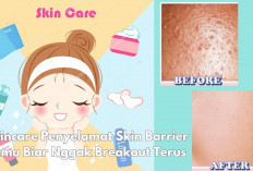 Skin Barrier Rusak? Coba 5 Skincare Ini, Dijamin Kulit Makin Glowing, Sehat & Bebas Iritasi