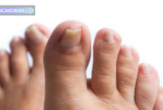 Bahaya Kuku Kaki Panjang Terungkap, Kenali Resikonya!