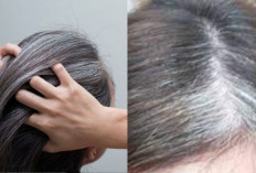 Masih Muda Tapi Rambut Udah Beruban? Ternyata Ini 4 Penyebabnya yang Jarang Disadari!