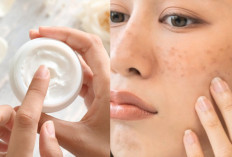 5 Rekomendasi Moisturizer yang Bisa Samarkan Flek Hitam & Mengecilkan Pori-pori, Kulit Cerah dalam Seminggu!