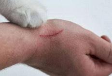 7 Cara Agar Tidak Dicakar Kucing Saat Sedang Mengelusnya, Nomor 1 Terjadi Karena Keselahanmu Sendiri, Kok Bisa